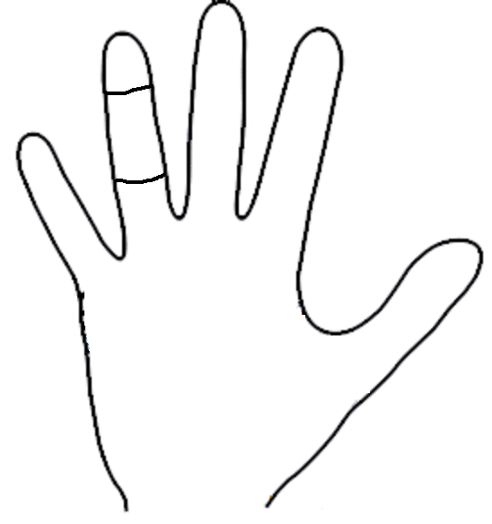 Little finger shorter than upper phalange of ring finger